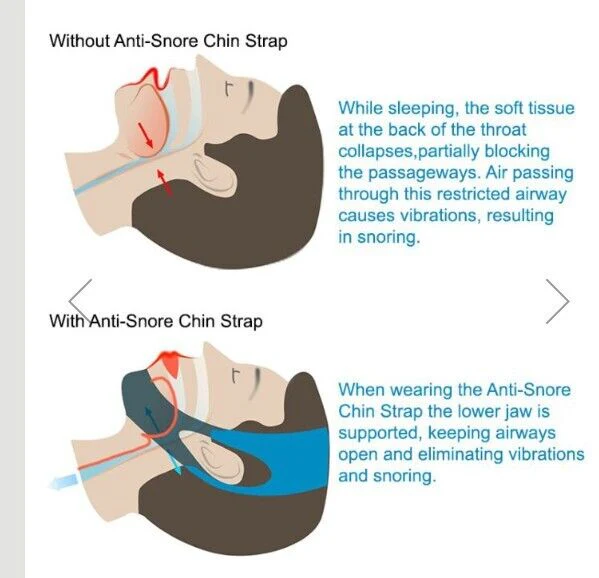 Anti Snore Chin Strap - Image 3
